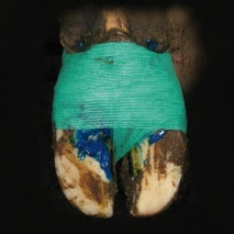 MS Selbstklebende Bandage, grün